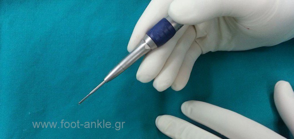 Διαδερμική Χειρουργικη