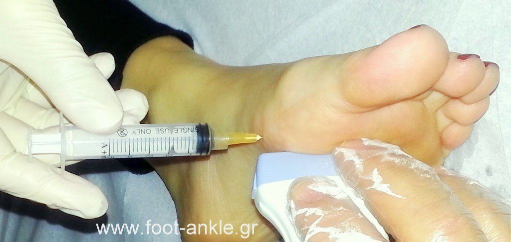 Θεραπευτικές Εγχύσεις